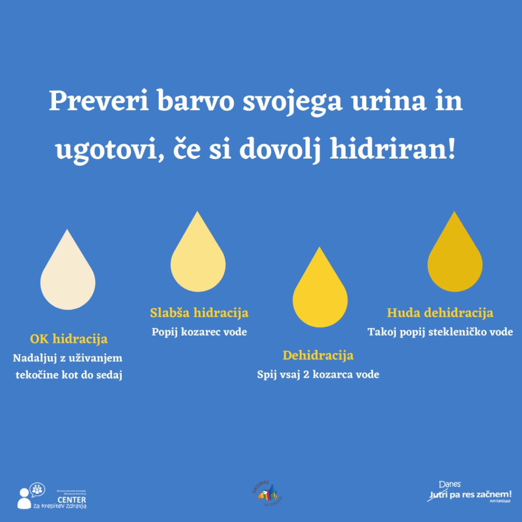 Infografika s kapljicami urina različnih barv, ki prikazujejo stanje hidracije – od OK hidracije do hude dehidracije.
